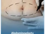 Abdominoplasty Abdominoplasty