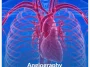 Angiography