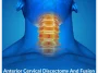Anterior-Cervical-Discectomy-And-Fusion Anterior-Cervical-Discectomy-And-Fusion