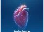 Arrhythmias Arrhythmias