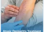 Atopic-Dermatitis-Treatment (1) Atopic-Dermatitis-Treatment (1)
