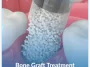 Bone-Graft-Treatment (1) Bone-Graft-Treatment (1)