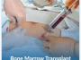 Bone-Marrow-Transplant-1