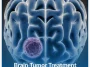 Brain-Tumor-Treatment Brain-Tumor-Treatment