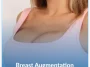 Breast-Augmentation
