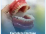 Complete-Denture (1)