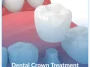 Dental-Crown-Treatment