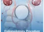 Endopyelotomy-Procedure