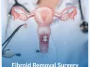 Fibroid-Removal-Surgery Fibroid-Removal-Surgery