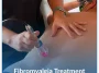 Fibromyalgia-Treatment (1) Fibromyalgia-Treatment (1)