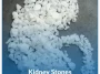 Kidney-Stones Kidney-Stones