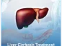 Liver-Cirrhosis-Treatment