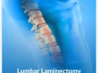 Lumbar-Laminectomy Lumbar-Laminectomy