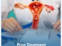 Pcos-Treatment Pcos-Treatment