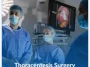 Thoracentesis-Surgery Thoracentesis-Surgery